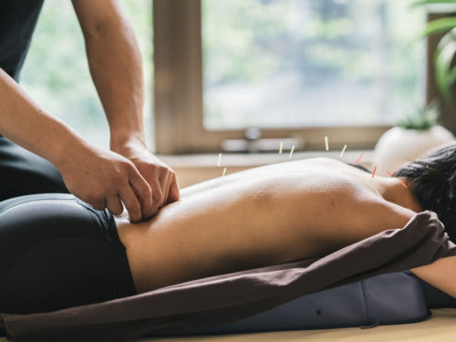 acupuncture-Wellington-Florida-Team-acupuncture