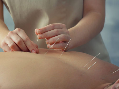 acupuncture-Wellington-Florida-Team-acupuncture