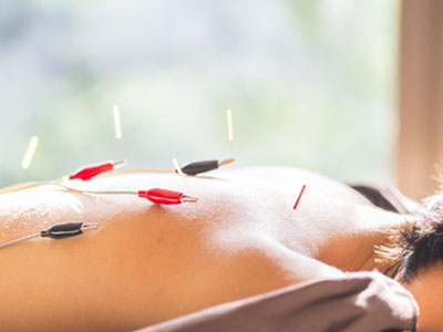acupuncture-Wellington-Florida-Team-acupuncture