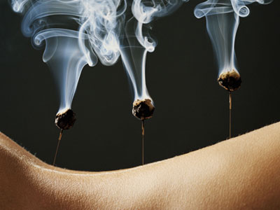 acupuncture-Wellington-Florida-Team-acupuncture