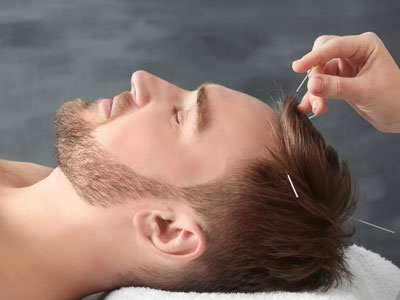 acupuncture-Wellington-Florida-Team-acupuncture