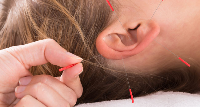 acupuncture-Wellington-Florida-Team-acupuncture