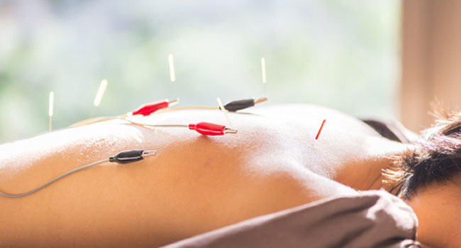 acupuncture-Wellington-Florida-Team-acupuncture