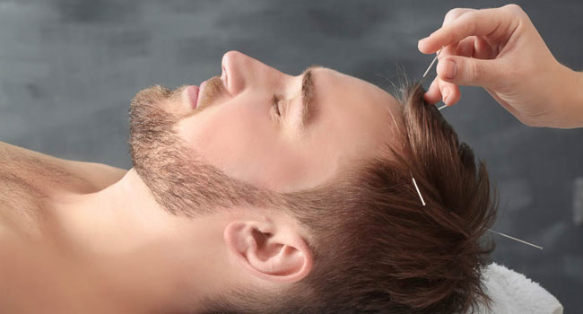 acupuncture-Wellington-Florida-Team-acupuncture