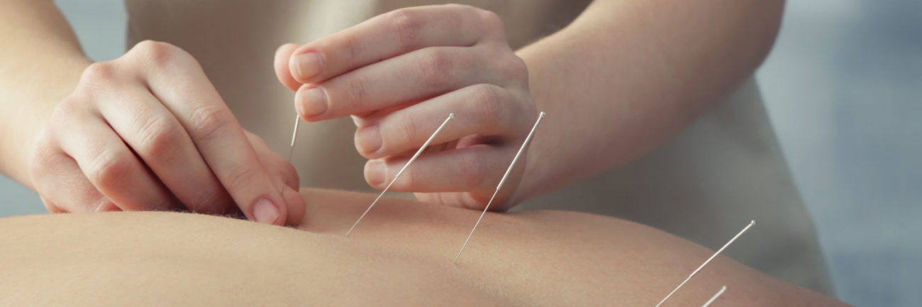 acupuncture-Wellington-Florida-Team-acupuncture-West-Palm-Beach