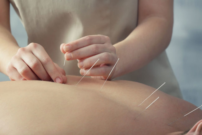 West-Palm-Beach’s-topnotch,-authentic,-and-skillful-Acupuncturist acupuncture-Wellington-Florida-Team-acupuncture-West-Palm-Beach