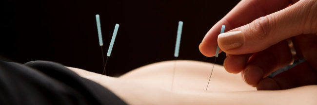 Is-Acupuncture-effective-for-pain Team acupuncture-cancer treatment- pain management-Infertility-Stress Management-pain-weight-moxibustion-Electro acupuncture-Auricular acupuncture-Scalp Acupuncture-cupping-chinese Herb- Facial rejuvenation-Electromagnetic healing-Tui na- chinese massage-Wellington-Florida-USA